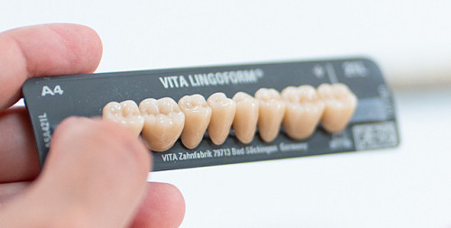 Dents Postérieures – Gamme LINGOFORM – VITA
