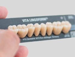 Dents Postérieures – Gamme LINGOFORM – VITA